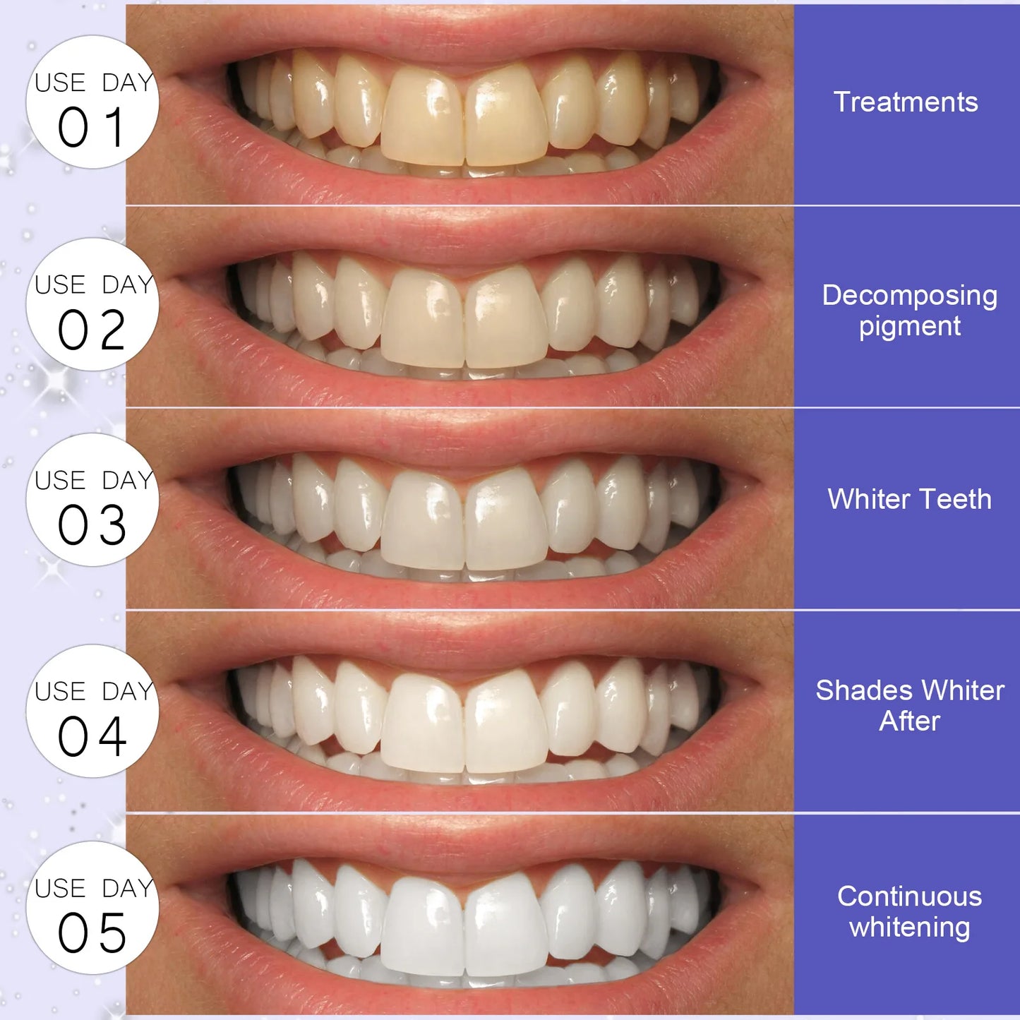 5D Teeth Whitening Strips Gel