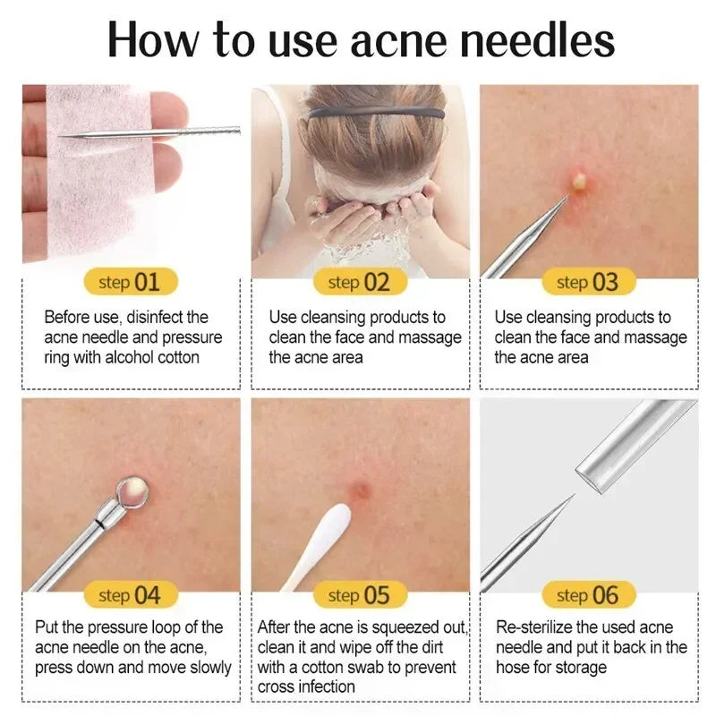 1/11Pcs Acne Pimples Blackhead Remover