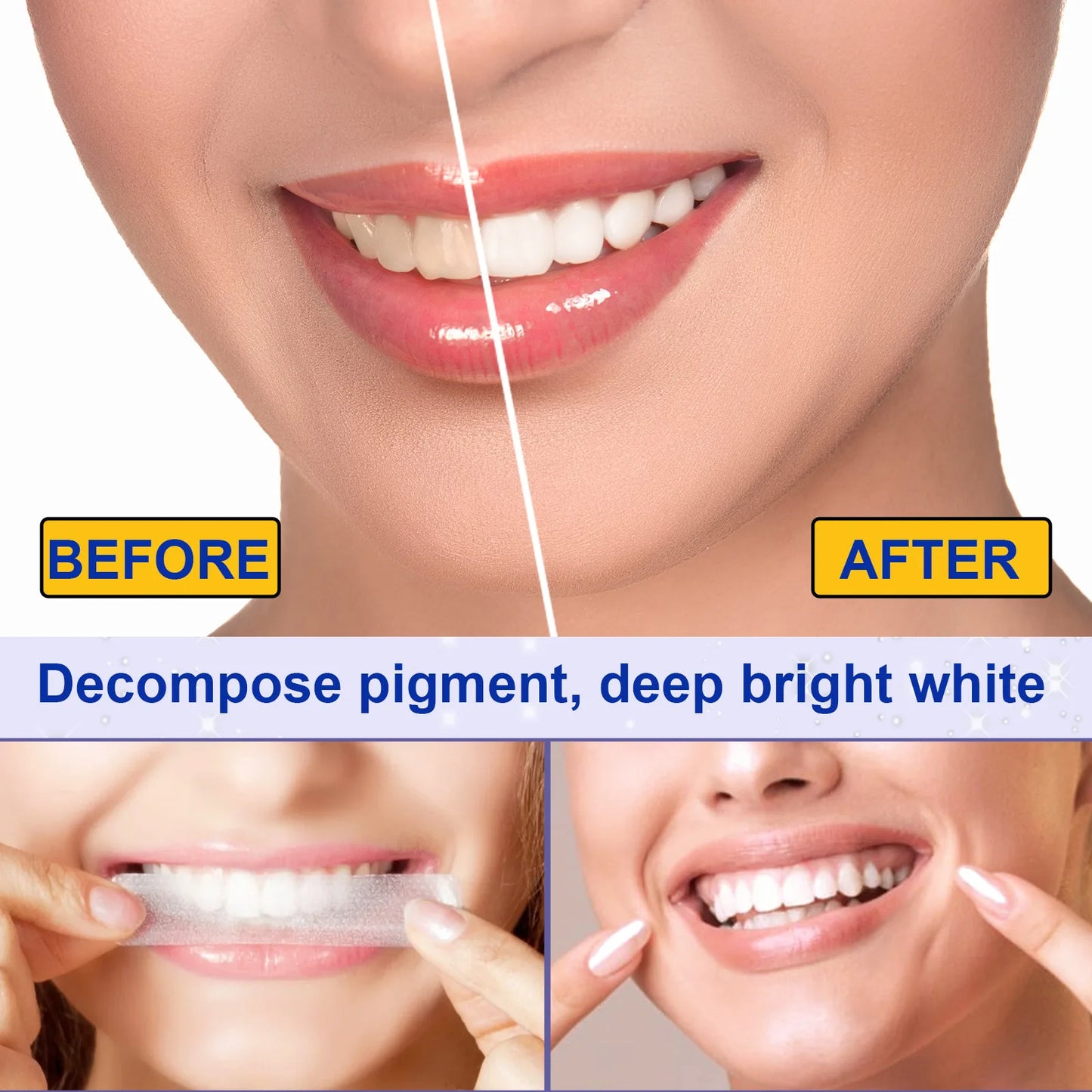 5D Teeth Whitening Strips Gel