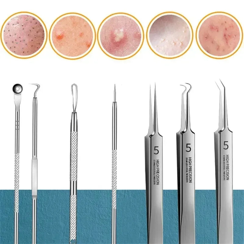 1/11Pcs Acne Pimples Blackhead Remover