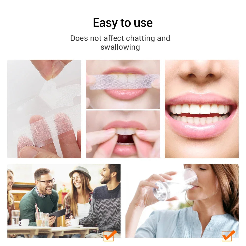 5D Teeth Whitening Strips Gel