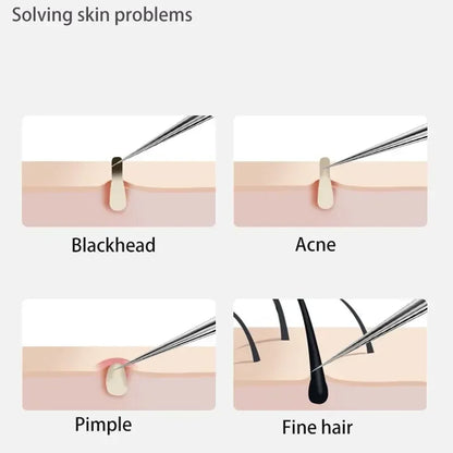 1/11Pcs Acne Pimples Blackhead Remover