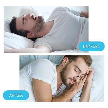 Boost Oxygen Intake Magnetic Nasal Dilator,Sleep