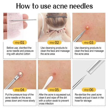 1/11Pcs Acne Pimples Blackhead Remover
