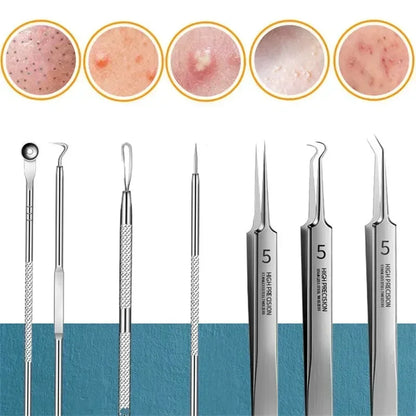 1/11Pcs Acne Pimples Blackhead Remover